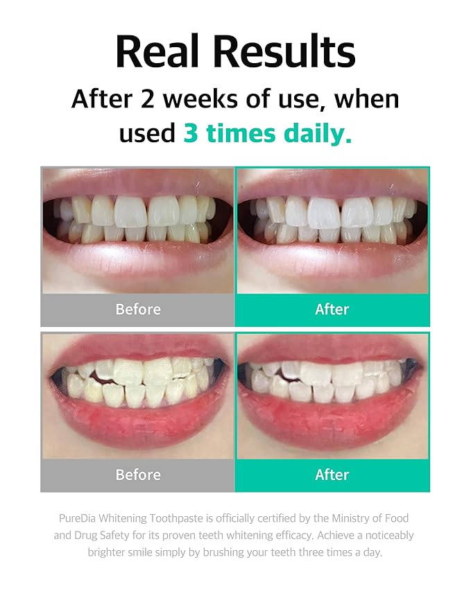 Live Orals Whitening Toothpaste 80g x 5 Units - Fluoride-Free Stain Removal, Strengthens Enamel, Natural Ingredients, Fresh Mint Flavor