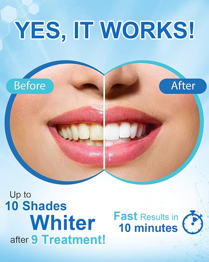 MySmile Non-Sensitive Teeth Whitening Pen Mint Gel Enamel Safety 8ML 30+ Treatments Fast Remove 20 Years of Stains Care Oral Bright Smile Alternative Teeth Whitening Strips ﻿
